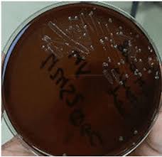 Image result for Neisseriaceae