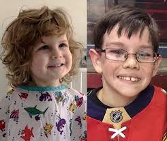 It presents with the common. How Families Are Reshaping Shwachman Diamond Syndrome Research Boston Children S Answers