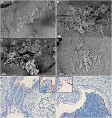Grammy award winning guitarist & composer. Extracellular Dna Release From The Genome Reduced Pathogen Mycoplasma Hyopneumoniae Is Essential For Biofilm Formation On Abiotic Surfaces Scientific Reports