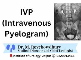 Image result for Intravenous Pyelogram