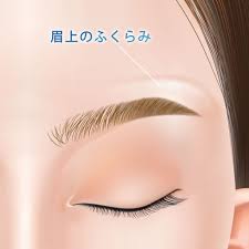 眉上ボトックスってどんな美容整形？向いている人の特徴を詳しく解説！｜金沢の美容外科はeクリニック