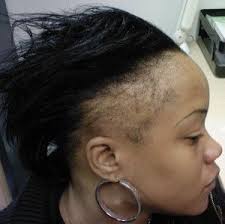 To go bare, bushy, or something in between has b. Regrowing Thin Edges And Bald Spots Caused By Alopecia With Essential Oils Natural Hair Styles Black Hair Care Hair Problems