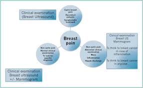 Lung cancer is the second most common cancer in the united states. Breast Pain And Imaging Sciencedirect