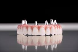 Image result for dentures