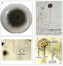 However, this occurs in certain fruits and some vegetables like grapes, onions, apricots, and peanuts, however, it is a common contaminant of food. Microscopic Photos Of Aspergillus Niger Van Tieghem A On Pda Download Scientific Diagram
