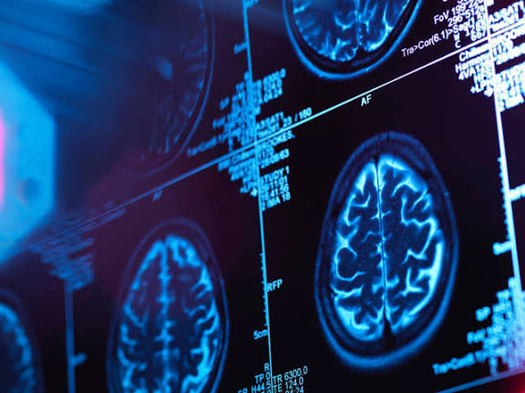 Women's brains are 'four years younger' than men's, study finds |  Neuroscience | The Guardian