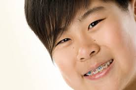 Customize Your Braces Children S Dental Village Orthodontics Phoenix Az Area