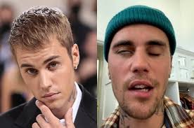 Justin Bieber has cancelled more Justice tour dates as his health problems  continue