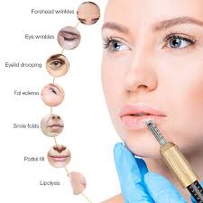 Until the invention of the hyaluron pen for lip infusions, the only other alternative is painfully, surgical alterations. Hyaluron Pen