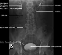 Abdominal Radiographic Anatomy Wikiradiography Radiology Student Medical Radiography Medical Knowledge