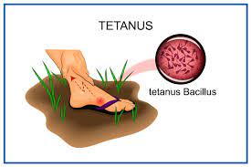 Tetanus : Dos And Don'ts,Causes & Risks, Treatment