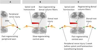 Diseases of the cranial nerves adams and victor's The Intriguing Nature Of Dorsal Root Ganglion Neurons Linking Structure With Polarity And Function Sciencedirect