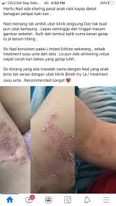 Mengenal berbagai jenis ikan koi koi adalah jenis ikan yang tidak pernah kehilangan penggemar. Penyakit Kayap Dah Sembuh Dengan Snow White Secrect Facebook