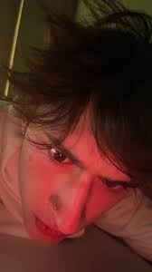 Can't Burp? Understanding No Burp Syndrome