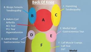 Knee Pain Diagnosis Chart Knee Pain Explained