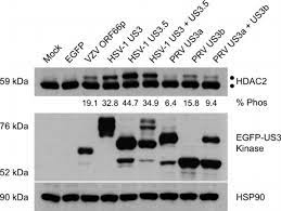 Analysis Of Hdac1 And Hdac2 Phosphorylation During Alphaherpesvirus Download Scientific Diagram