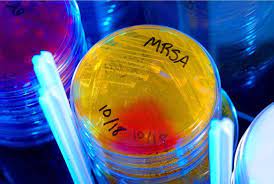 A mrsa test looks for the mrsa bacteria in a sample from a wound, nostril, or other body fluid. Mit Blauem Licht Gegen Superkeime Bestrahlung Konnte Mrsa Erreger Anfalliger Fur Antibakterielle Mittel Machen Scinexx De