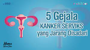 We did not find results for: Infografis 5 Gejala Kanker Serviks Yang Jarang Disadari Youtube