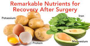 How to recover from surgery faster. Top 10 Foods To Eat After Surgery To Promote Healing