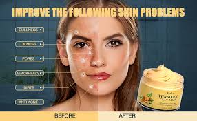 Taking 5 tbsp of milk (nut or animal) or rose water, add it to the powder mix until it creates a paste. Amazon Com Turmeric Face Mask Meliza Clay Face Mask With Turmeric And Kaolin Clay Detox Face Mask With Face Mask Brush For Skin Care Organic Turmeric Face Mud Mask For Deep Cleansing