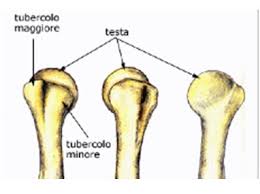• trattamento post operatorio delle fratture di òmero, scapola clavicola (floating shoulder). Frattura Omero Dott De Biase Ortopedico Della Spalla