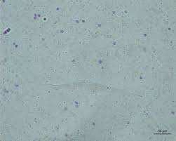 Discuss heartworm disease and treatment with the client. Detection Of Heartworm Antigen Without Cross Reactivity To Helminths And Protozoa Following Heat Treatment Of Canine Serum Parasites Vectors Full Text