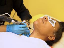 Ipl proved as popular as laser hair removal and many clinical studies led to improvements in technology, safety, comfort and results. Laser Hair Removal Everything You Need To Know Racked