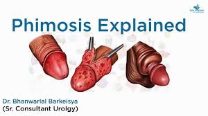 Image result for Phimosis