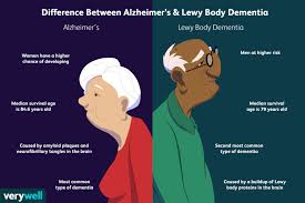 There are five types of dementia and 13 stages of the disease. Difference Between Alzheimer S And Lewy Body Dementia