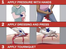 There may be a situation or relationship that needs to be repaired. Resource Hub Stop The Bleed