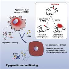 Liver cancer is one of the most common cancers in hong kong. Differentiation Therapy By Epigenetic Reconditioning Exerts Antitumor Effects On Liver Cancer Cells Molecular Therapy