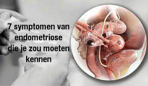We did not find results for: Zeven Symptomen Van Endometriose Die Je Moet Kennen Gezonder Leven