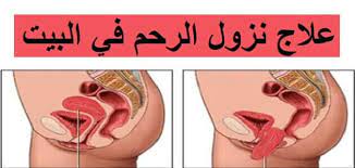نزول الرحم والحمل المرأة العصرية