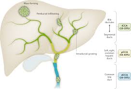 Johnson succumbed to his wounds tuesday, june 30, 2020, at saint francis hospital. Cholangiocarcinoma 2020 The Next Horizon In Mechanisms And Management Nature Reviews Gastroenterology Hepatology