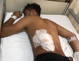 Chp Stant Saldirisinda Agir Yaralanan Bir Genclik Kolu Uyemiz Yogun Bakimda Bbc News Turkce Bbc Genclik Yoga