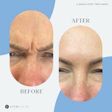 Stephanie Scott/ nurse injector