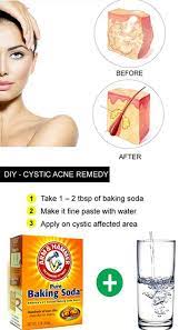 I'm in a big city until new years so i have access to basically any store (including i have this problem too and i use origins active charcoal mask about once a week all over and as overnight spot treatment and it really helps. Here Are 15 Diy Hacks Tips And Tricks That Will Make That Acne Vanish Overnight Cystic Acne Remedies Cystic Acne Treatment Acne Cure