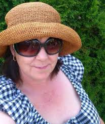 WEAR A WIDE-BRIMMED HAT (+ OTHER UV PROTECTION ADVICE) FOR #lupus: SHARE  with everyone who has lupus. I was so happy to walk into the examination  room and see H.G. today! You