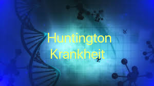 Erste anzeichen der huntington krankheit können sein: Was Ist Die Huntington Krankheit Symptome Ursachen Und Behandlung Medizin Fitness Ernahrung