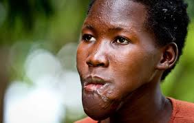 Joseph Kony Destroyed my Life: Abductee Speaks