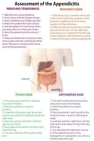 9 Tips For Performing A Nursing Health Assessment On The Gastrointestinal System In 2020 Medical Surgical Nursing Assessment Surgical Nursing