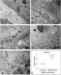 Roa +2 rivals of aether. Em Analysis Of Sinusoidal Modifications In Hcv Infected Liver A B Download Scientific Diagram
