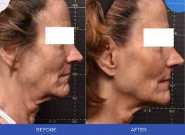 Treiber Dermatology Associates