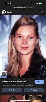 Elisabeth Moss injured