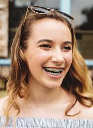 Value-Added Orthodontic Discount Program