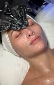 Dull, Dry & Dehydrated Skin