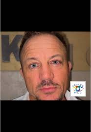 New eyes, who this? 🧿✨😍Take a look at Timothy’s NEW Magical Grey eyes.  💙🙌🏻 Changing your eye color is now possible with the Kerato Eye Color  Change procedure.✨ Discover more by contacting us! ...