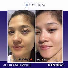 Maybe you would like to learn more about one of these? Ulasan Dan Review Terbukti Ampuh Cream Pemutih Wajah Trulum 120ml Skincare Anti Aging Trulum Store