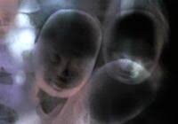 The doll's clothes, wigs, shoes, eyes, accessories and judy dolls are with you. Judy Dolls Grey S Anatomy Universe Wiki Fandom