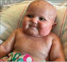 2019 CIS Annual Meeting: Immune Deficiency & Dysregulation North American  Conference